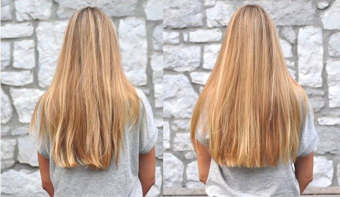 La chute des cheveux chez les femmes des nerfs